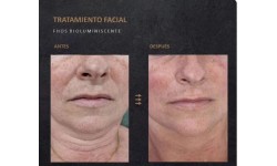 SERVICIOS: Sesión Fhos Recuperadora