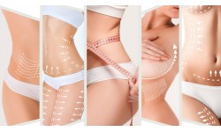 SERVICIOS: Bono Radiofrecuencia facial 6 sesiones